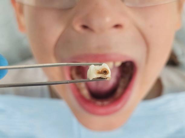 Best Cracked Tooth Emergency Dentist  in Minor, AL